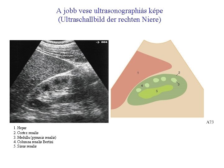 A jobb vese ultrasonographiás képe (Ultraschallbild der rechten Niere) 1. Hepar 2. Cortex renalis