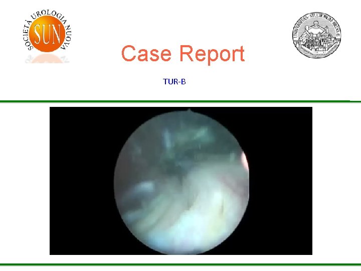 Case Report TUR-B 