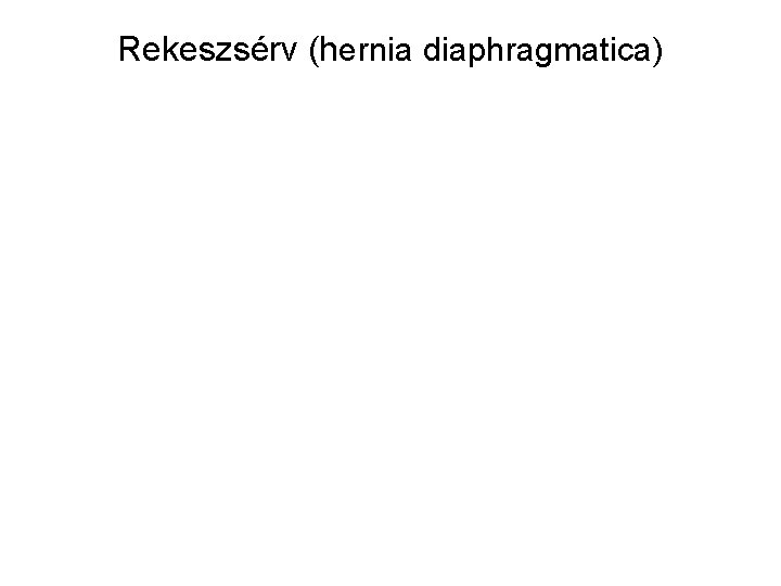 Rekeszsérv (hernia diaphragmatica) Rekeszsérv (hernia diaphragmatica)