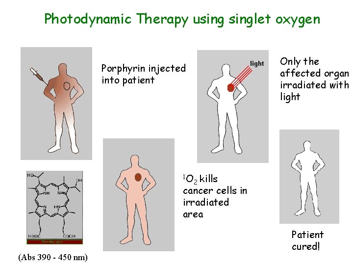Photodynamic Therapy usinglet oxygen Only the affected organ irradiated with light Porphyrin injected into