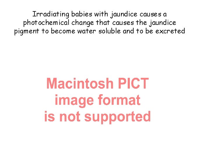 Irradiating babies with jaundice causes a photochemical change that causes the jaundice pigment to