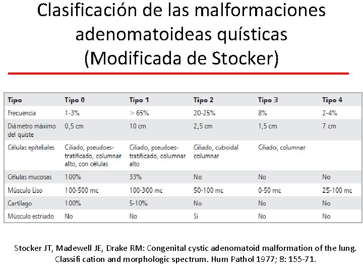 Clasificación de las malformaciones adenomatoideas quísticas (Modificada de Stocker) Stocker JT, Madewell JE, Drake