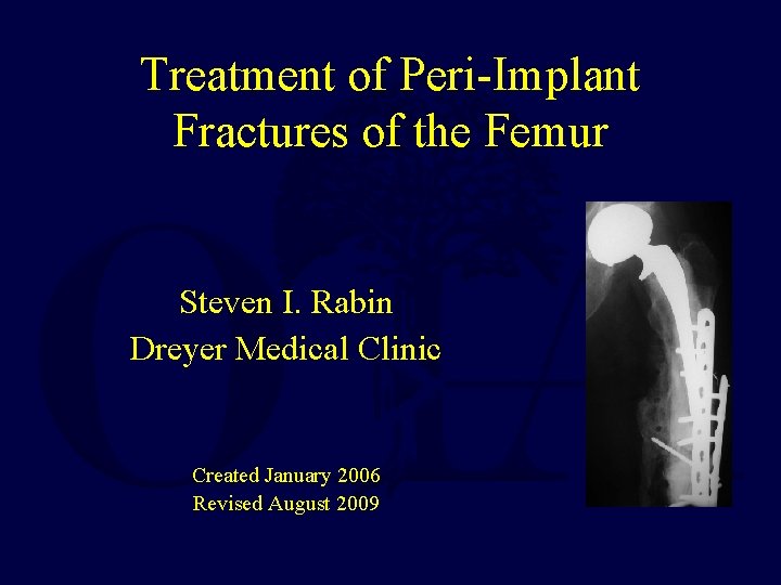 Treatment of Peri-Implant Fractures of the Femur Steven I. Rabin Dreyer Medical Clinic Created