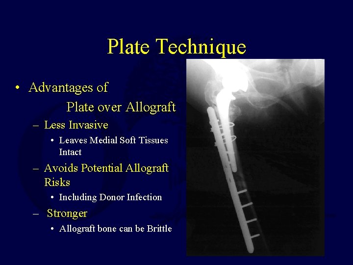 Plate Technique • Advantages of Plate over Allograft – Less Invasive • Leaves Medial
