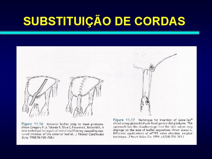 SUBSTITUIÇÃO DE CORDAS 