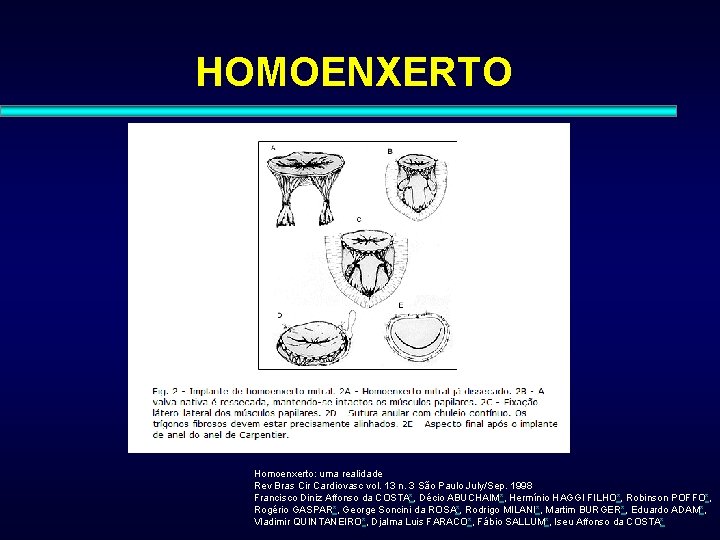 HOMOENXERTO Homoenxerto: uma realidade Rev Bras Cir Cardiovasc vol. 13 n. 3 São Paulo