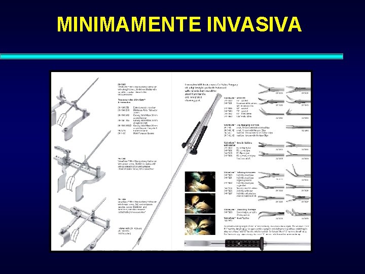 MINIMAMENTE INVASIVA 