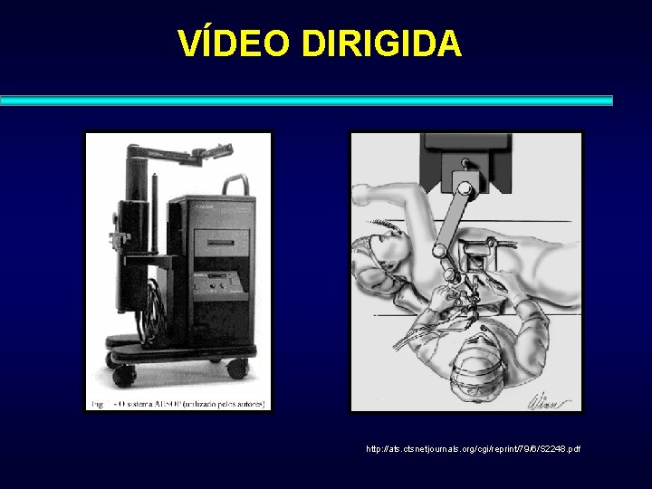 VÍDEO DIRIGIDA http: //ats. ctsnetjournals. org/cgi/reprint/79/6/S 2248. pdf 