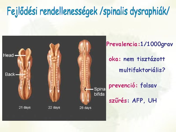 Prevalencia: 1/1000 grav oka: nem tisztázott multifaktoriális? prevenció: folsav szűrés: AFP, UH 