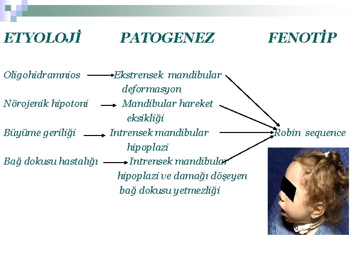 ETYOLOJİ Oligohidramnios Nörojenik hipotoni Büyüme geriliği Bağ dokusu hastalığı PATOGENEZ Ekstrensek mandibular deformasyon Mandibular