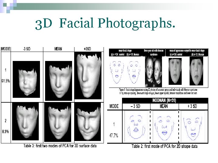 3 D Facial Photographs. 