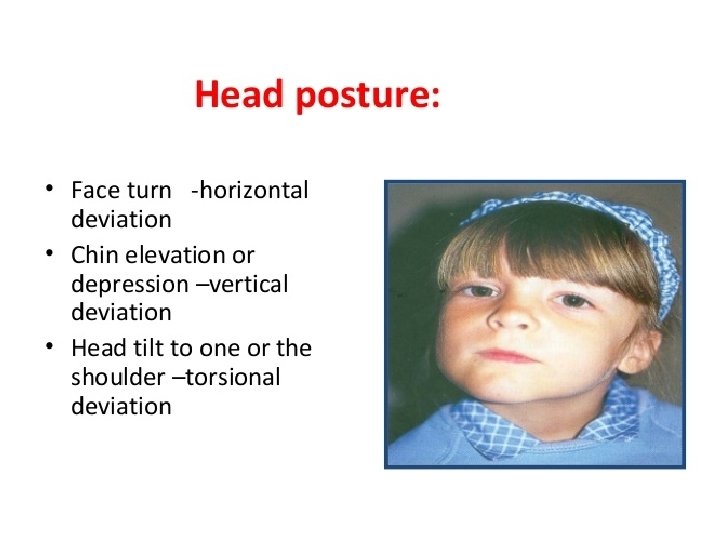  • Head Posture 