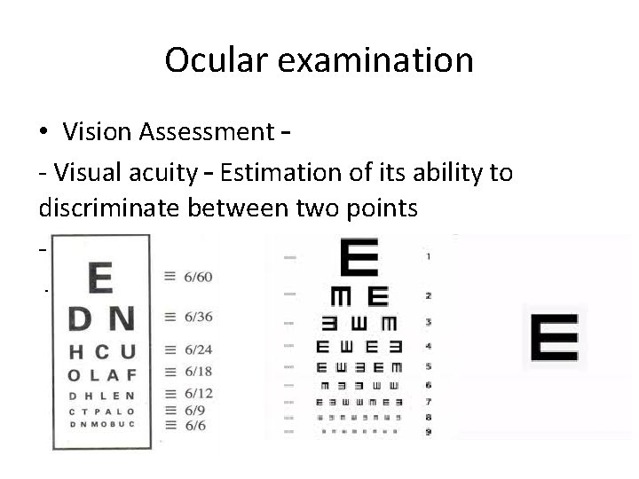 Ocular examination • Vision Assessment – - Visual acuity – Estimation of its ability