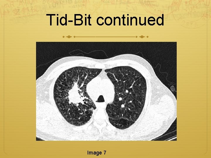 Tid-Bit continued Image 7 