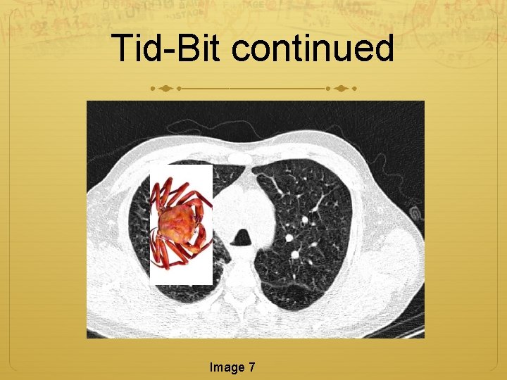 Tid-Bit continued Image 7 