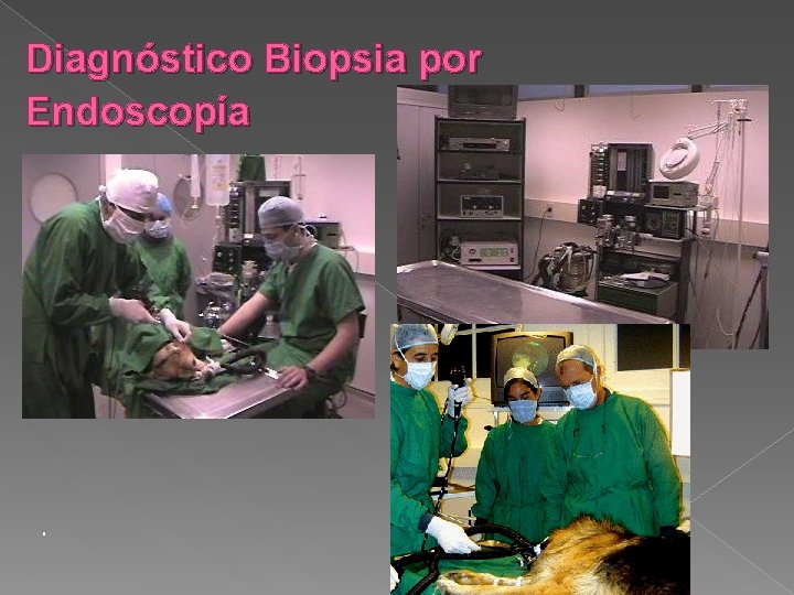 Diagnóstico Biopsia por Endoscopía . 