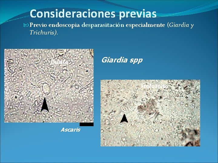 Consideraciones previas Previo endoscopia desparasitación especialmente (Giardia y Trichuris). Quiste Giardia spp Trofozoito Ascaris