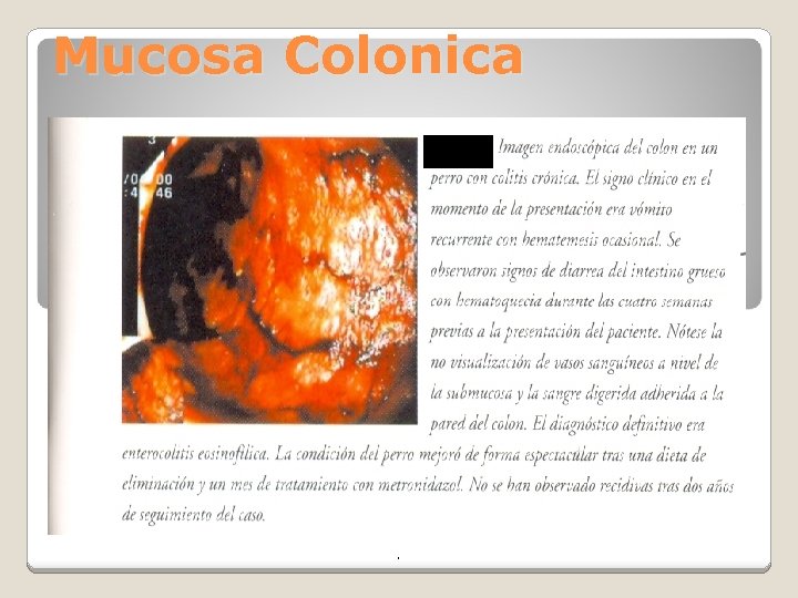 Mucosa Colonica . 