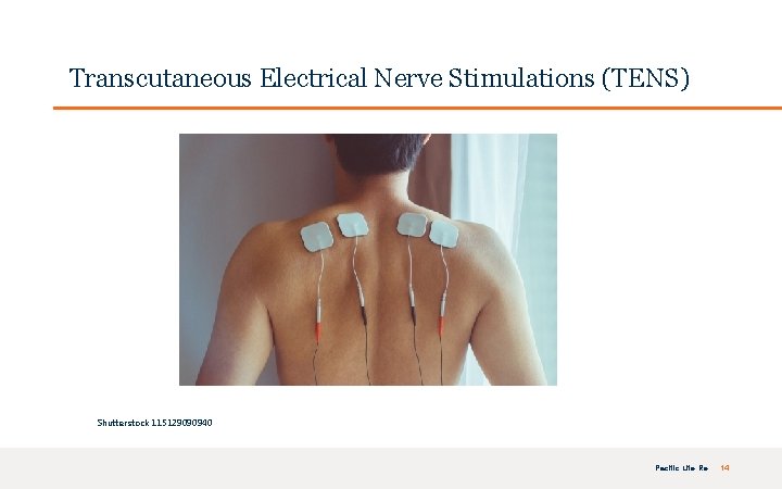 FOR INTERNAL USE ONLY | PRIVATE & CONFIDENTIAL Transcutaneous Electrical Nerve Stimulations (TENS) Shutterstock