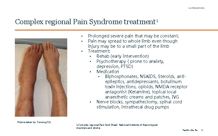 FOR INTERNAL USE ONLY / PRIVATE & CONFIDENTIAL Complex regional Pain Syndrome treatment 1