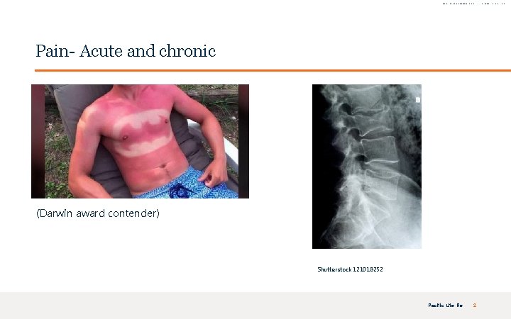 FOR INTERNAL USE ONLY | PRIVATE & CONFIDENTIAL Pain- Acute and chronic (Darwin award