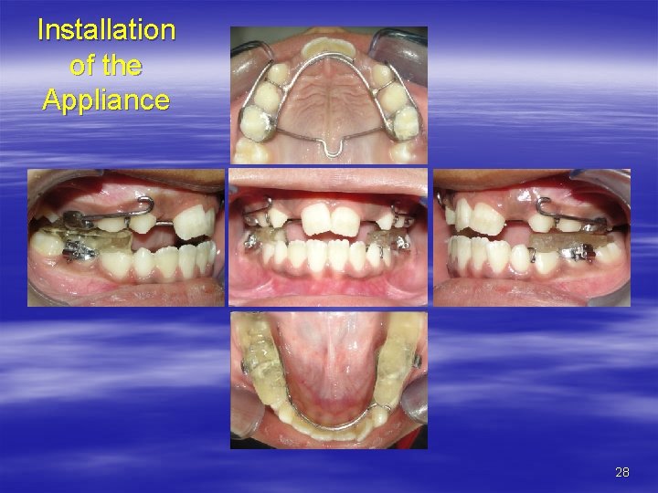 Installation of the Appliance 28 