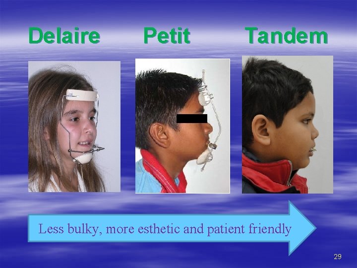 Delaire Petit Tandem Less bulky, more esthetic and patient friendly 29 