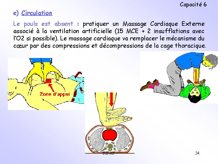 Capacité 6 e) Circulation Le pouls est absent : pratiquer un Massage Cardiaque Externe