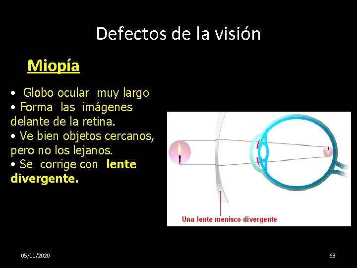 Defectos de la visión Miopía • Globo ocular muy largo • Forma las imágenes