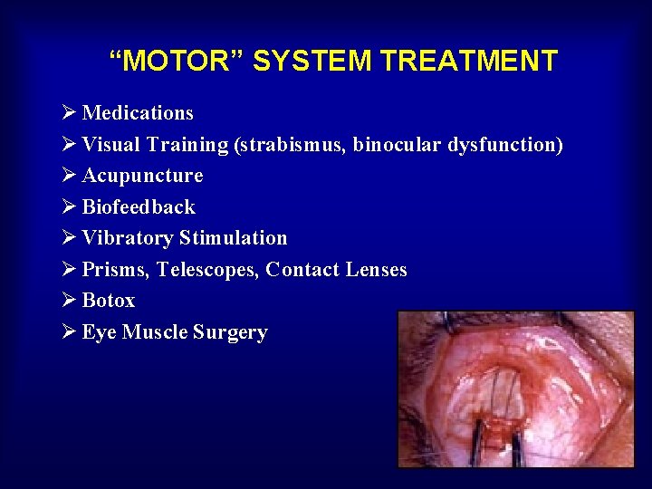 “MOTOR” SYSTEM TREATMENT Ø Medications Ø Visual Training (strabismus, binocular dysfunction) Ø Acupuncture Ø