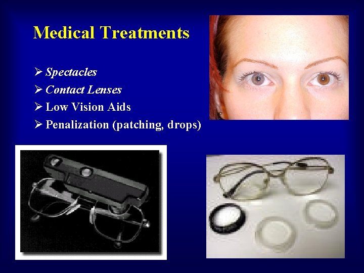 Medical Treatments Ø Spectacles Ø Contact Lenses Ø Low Vision Aids Ø Penalization (patching,