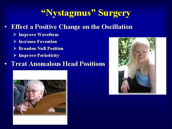 “Nystagmus” Surgery • Effect a Positive Change on the Oscillation Ø Ø Improve Waveform