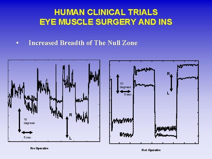 HUMAN CLINICAL TRIALS EYE MUSCLE SURGERY AND INS • Increased Breadth of The Null