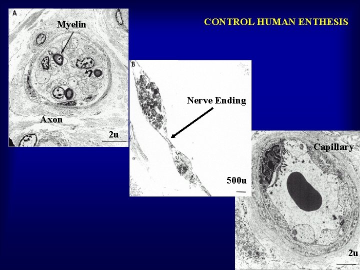 CONTROL HUMAN ENTHESIS Myelin Nerve Ending Axon 2 u Capillary 500 u 2 u