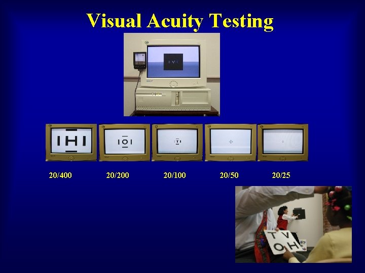 Visual Acuity Testing 20/400 20/200 20/100 20/50 20/25 