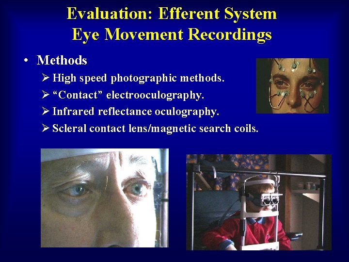 Evaluation: Efferent System Eye Movement Recordings • Methods Ø High speed photographic methods. Ø