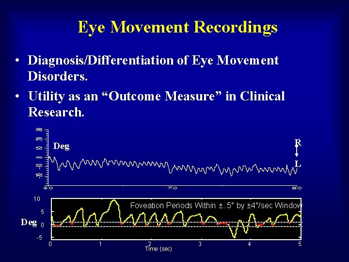 Eye Movement Recordings • Diagnosis/Differentiation of Eye Movement Disorders. • Utility as an “Outcome