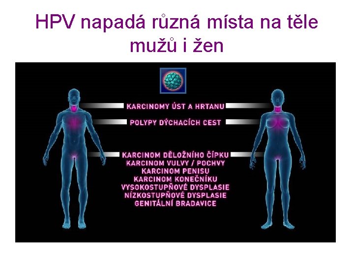 HPV napadá různá místa na těle mužů i žen 