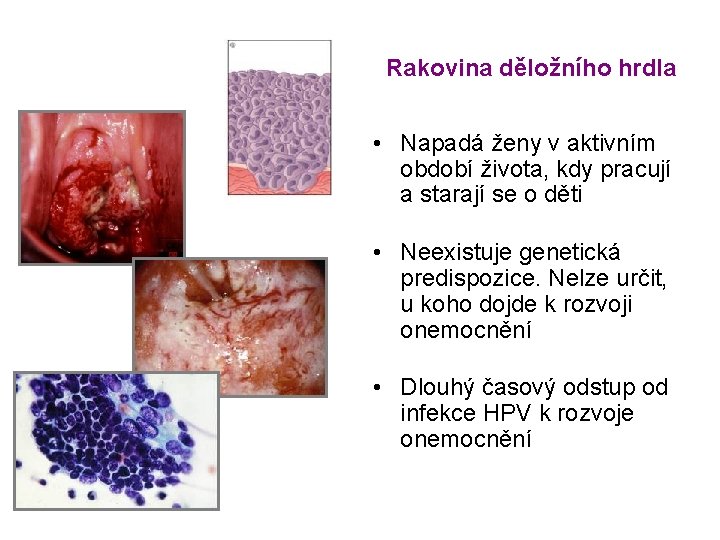 Rakovina děložního hrdla • Napadá ženy v aktivním období života, kdy pracují a starají