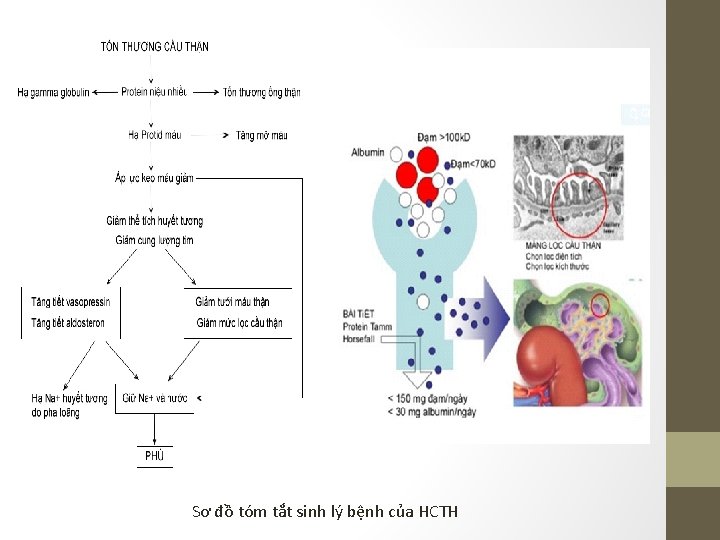 Sơ đồ tóm tắt sinh lý bệnh của HCTH 