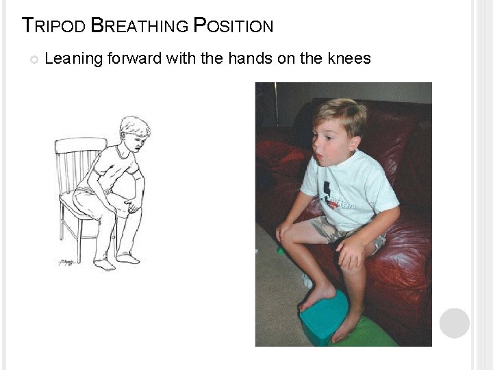 TRIPOD BREATHING POSITION Leaning forward with the hands on the knees 