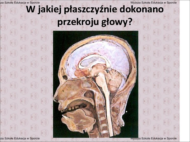 W jakiej płaszczyźnie dokonano przekroju głowy? 