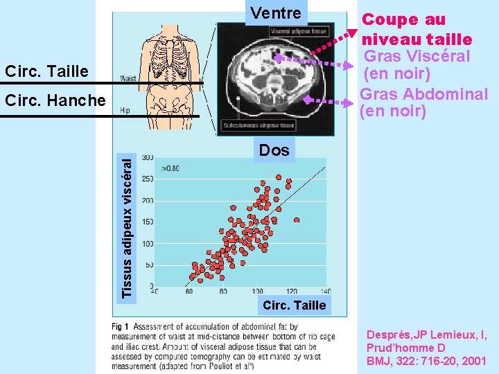 Ventre Circ. Taille Tissus adipeux viscéral Circ. Hanche Coupe au niveau taille Gras Viscéral