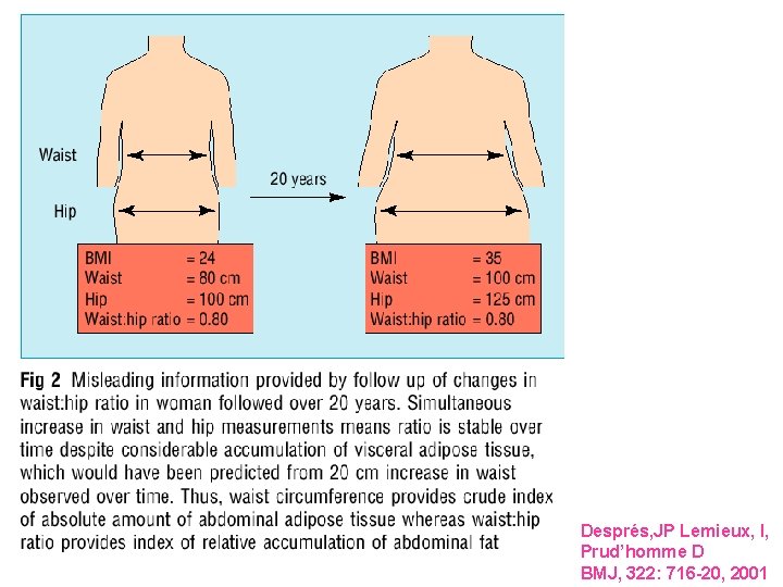 Després, JP Lemieux, I, Prud’homme D BMJ, 322: 716 -20, 2001 