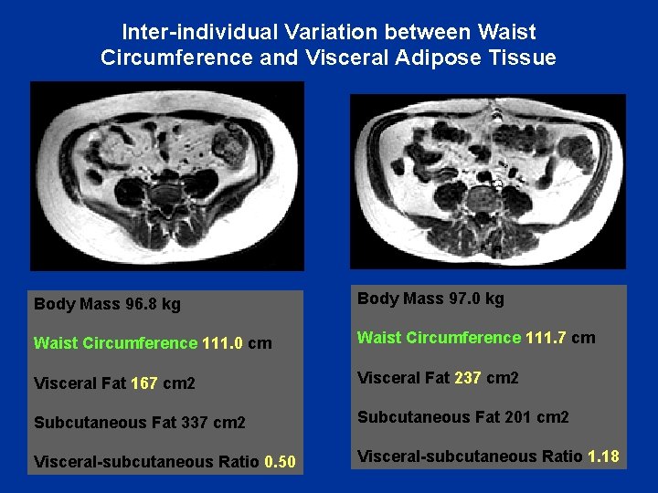 Inter-individual Variation between Waist Circumference and Visceral Adipose Tissue Body Mass 96. 8 kg