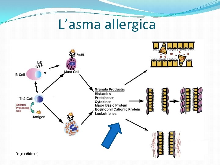 L’asma allergica [B 1, modificata] 