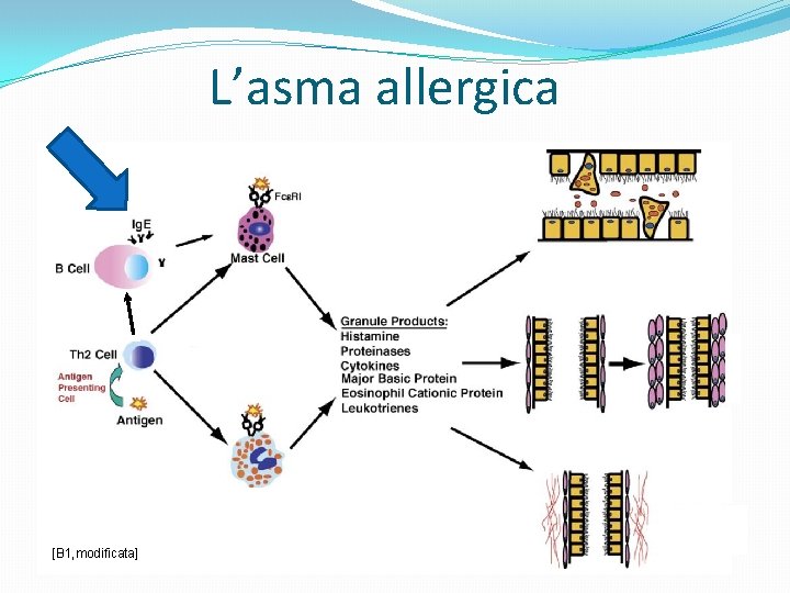 L’asma allergica [B 1, modificata] 