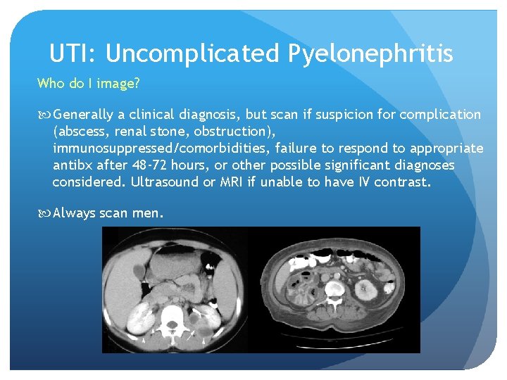 UTI: Uncomplicated Pyelonephritis Who do I image? Generally a clinical diagnosis, but scan if
