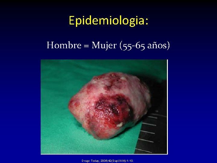 Epidemiologia: Hombre = Mujer (55 -65 años) Drugs Today, 2006; 42(Supl. IV/A): 1 -10. Epidemiologia: Hombre = Mujer (55 -65 años) Drugs Today, 2006; 42(Supl. IV/A): 1 -10.