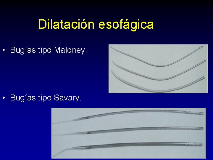 Dilatación esofágica • Bugías tipo Maloney. • Bugías tipo Savary. Dilatación esofágica • Bugías tipo Maloney. • Bugías tipo Savary.